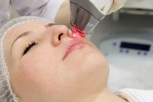 Fractional laser facial skin rejuvenation process