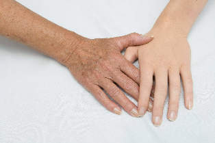 skin rejuvenation of the hands