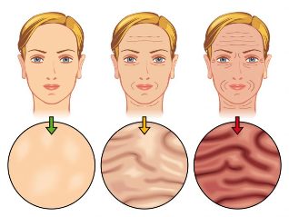 the stage of aging of the skin